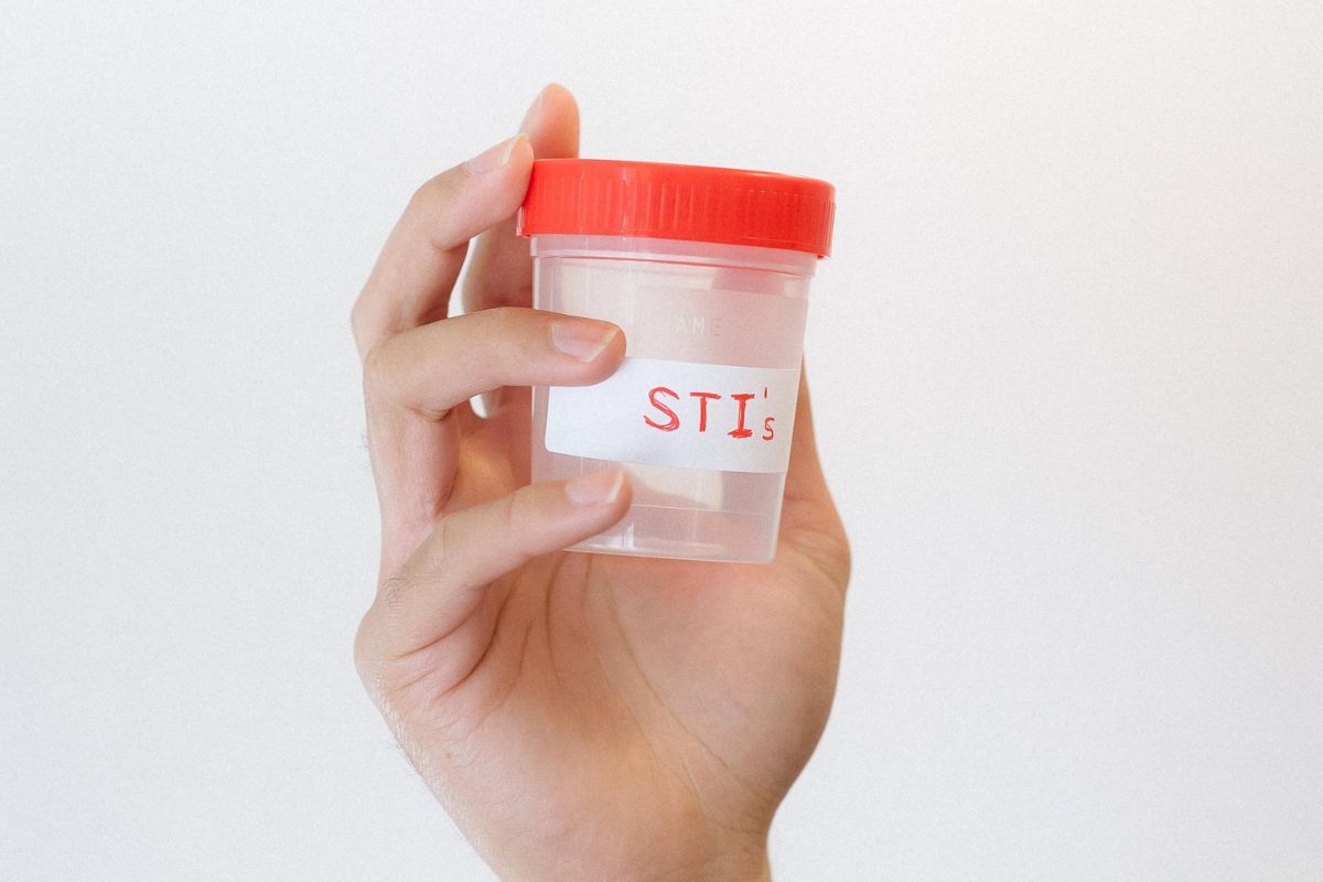 SEXUALLY TRANSMITTED DISEASES AND DIAGNOSTIC TESTS