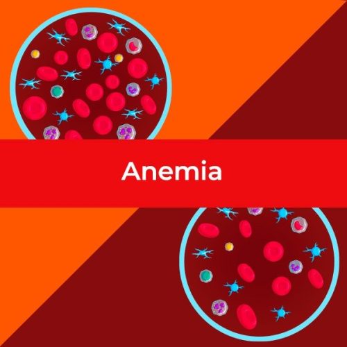 21_anemia