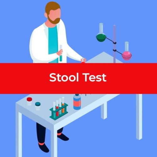 22_stool-test