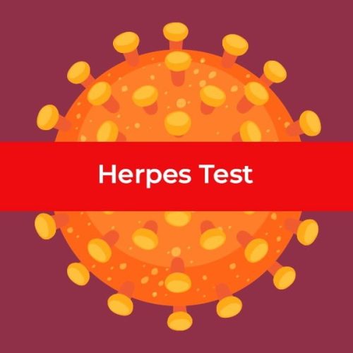 28_herpes-test