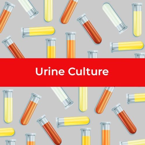 29_urine-culture